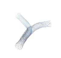 Double Pigtail Biliary Stent • Diagmed